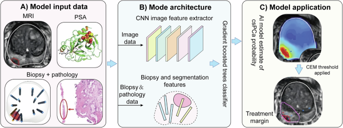 Fig. 4: Three Core Challenges (Data/Model/Clinical) in the Application of AI in Prostate Cancer Diagnostic Imaging (adapted/redrawn from published work and publicly available data52).