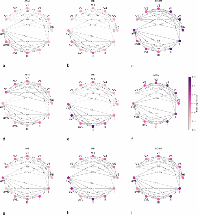 Fig. 4: Average node and edge importance computed by GNNExplainer across samples for different classification tasks.
