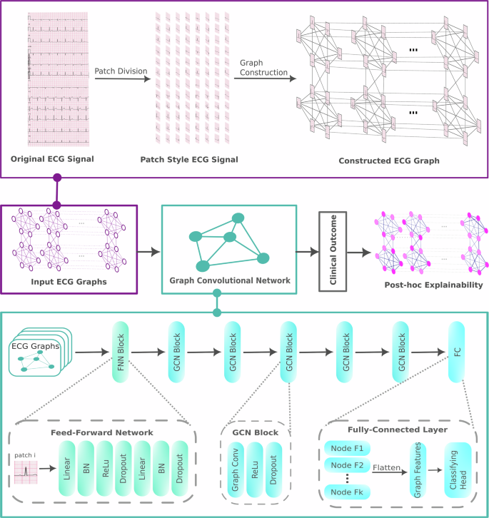 Fig. 5: Schematic workflow: the nodes represent the signals, and the edges represent the physiological connections that can be created in accordance with the electrode position and vector space of the lead systems.