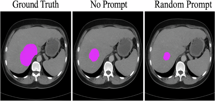 Fig. 4: Qualitative impact of prompting strategies.