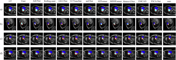 Fig. 1: Qualitative comparison of segmentation results on the ACDC dataset.