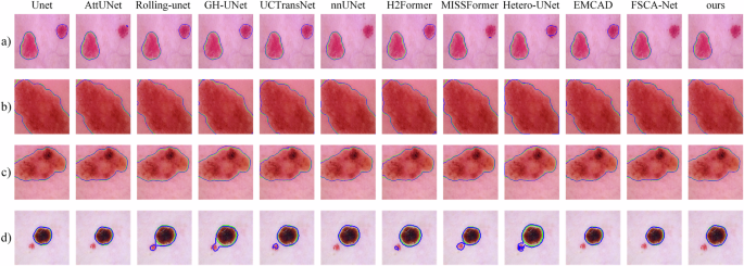 Fig. 3: Qualitative comparison of segmentation results on the ISIC dataset.