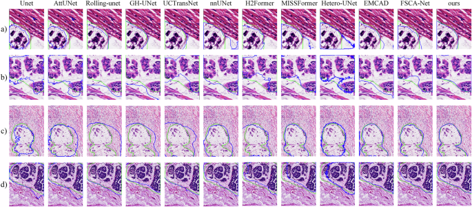 Fig. 4: Qualitative comparison of segmentation results on the SEED pathology dataset.