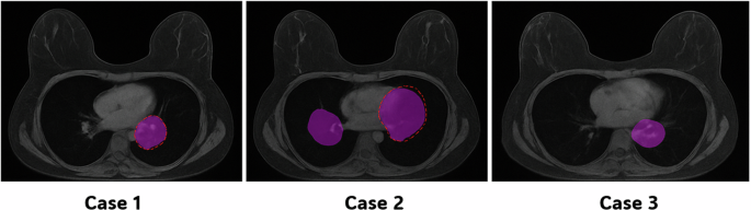 Fig. 1: Effect of anatomy-guided prompts.