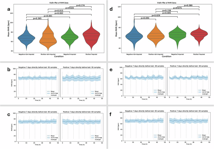 Fig. 1: Resting heart rate (RHR) profiles reveal infection-related differences and benefit from GAN-based imputation.
