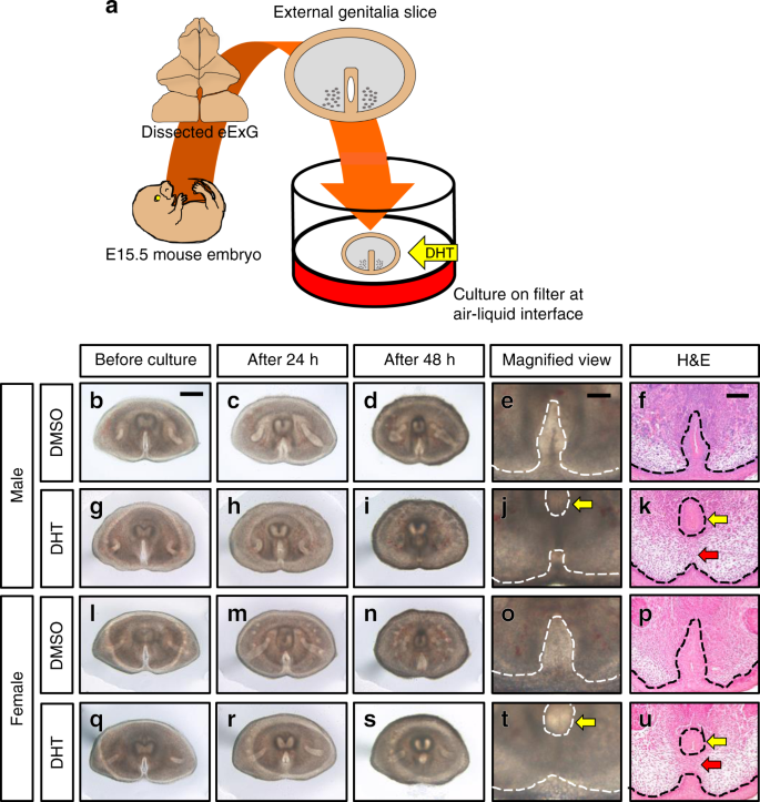 Mesenchymal Actomyosin Contractility Is Required For Androgen Driven Urethral Masculinization In Mice Communications Biology