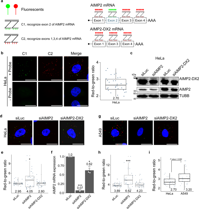 Single Cell Analysis Of Aimp2 Splice Variants Informs On Drug Sensitivity And Prognosis In Hematologic Cancer Communications Biology Single Cell Analysis Of Aimp2 Splice Variants Informs On Drug Sensitivity And Prognosis In Hematologic Cancer Communications Biology
