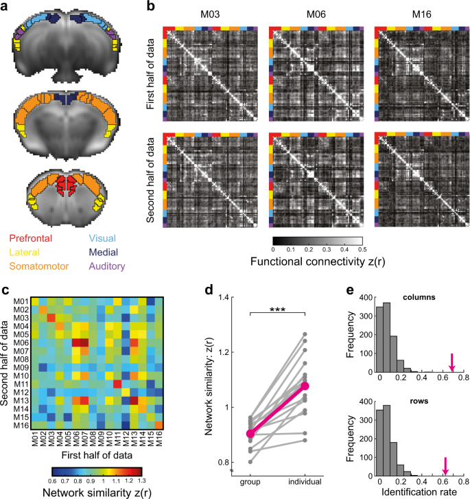 Distribution of intersubject variability in the masked