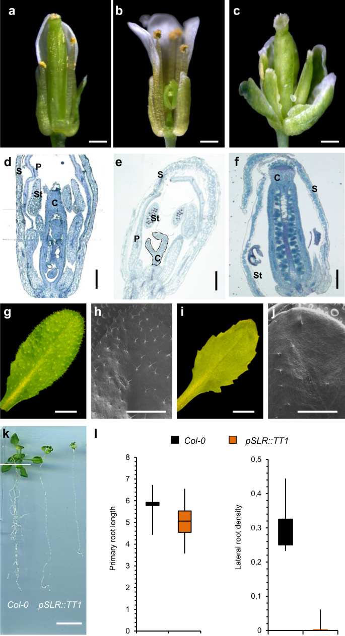 Fig. 5: Ectopic expression of TT1 in reproductive and vegetative organs of Arabidopsis.
