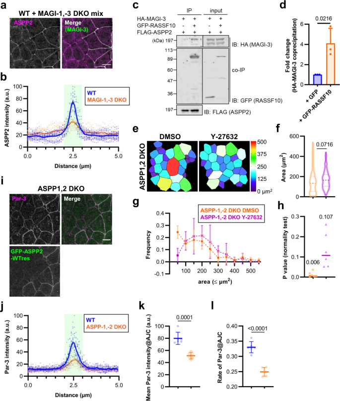 MAGIs regulate aPKC to enable balanced distribution of intercellular  tension for epithelial sheet homeostasis | Communications Biology