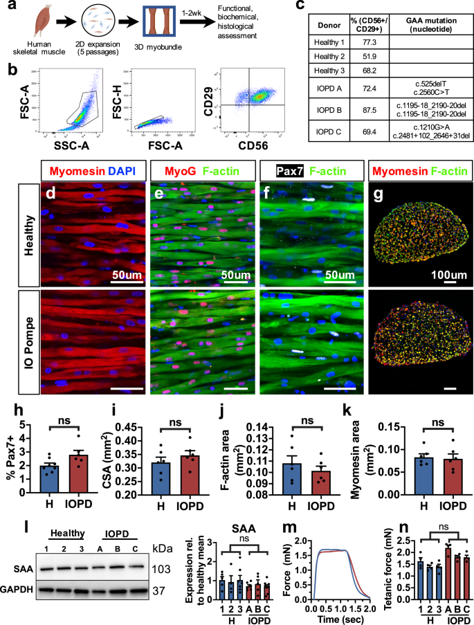 rare Sanction relief Three-dimensional tissue-engineered human skeletal muscle model of Pompe  disease | Communications Biology