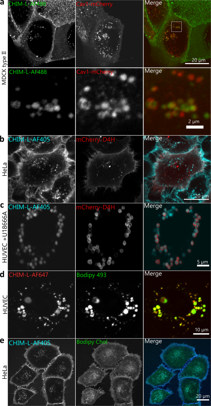 Fig 4: CHIM-L mimics the cholesterol distribution in live cells.