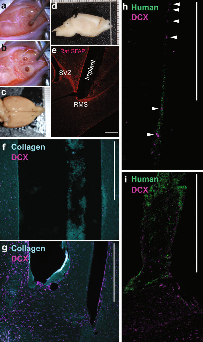 An implantable human stem cell-derived tissue-engineered rostral migratory  stream for directed neuronal replacement | Communications Biology