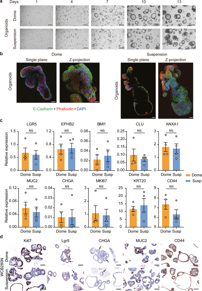 Fig. 3: Colorectal organoids grown in low-viscosity matrix suspension recapitulate morphological development observed in dome culture.