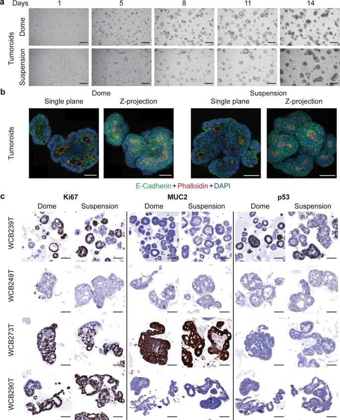Fig. 4: Colorectal tumoroids grown in low-viscosity matrix suspension recapitulate morphological development observed in dome culture.