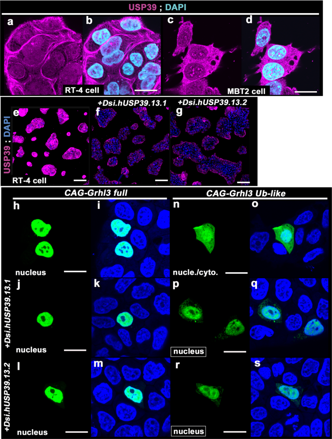 Fig. 2: Localization of Ub-like domain of GRHL3 overlapping with USP39 expression.