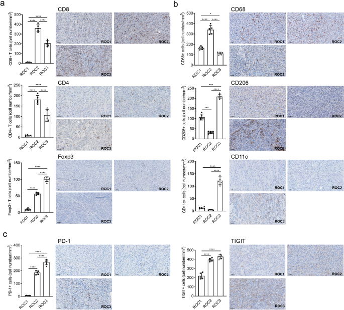 Fig. 2: ROC1–3 TIMEs have distinct patterns of immune infiltration and exclusion.