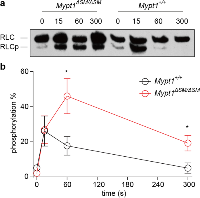 Fig. 3: RLC phosphorylation in MYPT1-deficient dorsal arteries in response to PE stimulation.