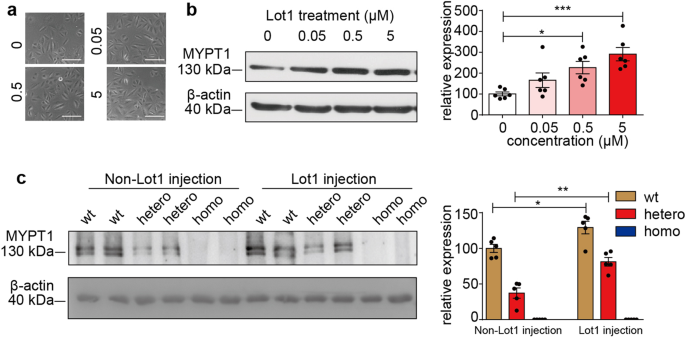 Fig. 5: MYPT1 expression was increased by lotusine treatment both in vivo and in vitro.