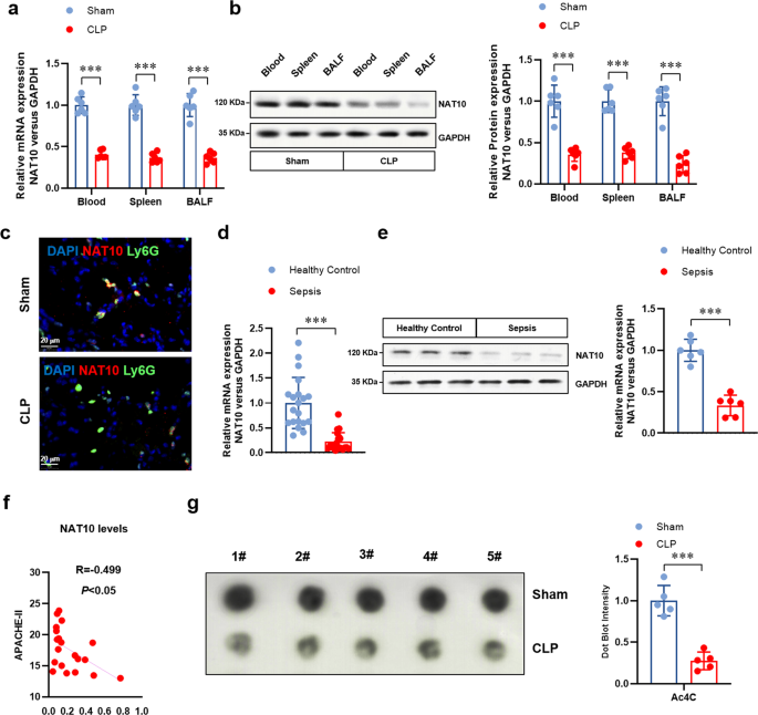 Fig. 2: The expression of NAT10 decreased in neutrophils from septic mice and patients.