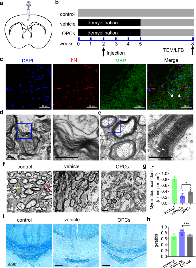 Fig. 4: smRNA-induced OPCs give rise to functional myelin following transplantation in the brains of mice with cuprizone-induced demyelination.