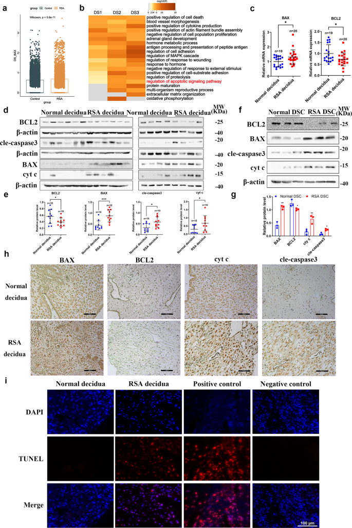 Fig. 4: Apoptotic level was upregulated in RSA decidual stromal cells.