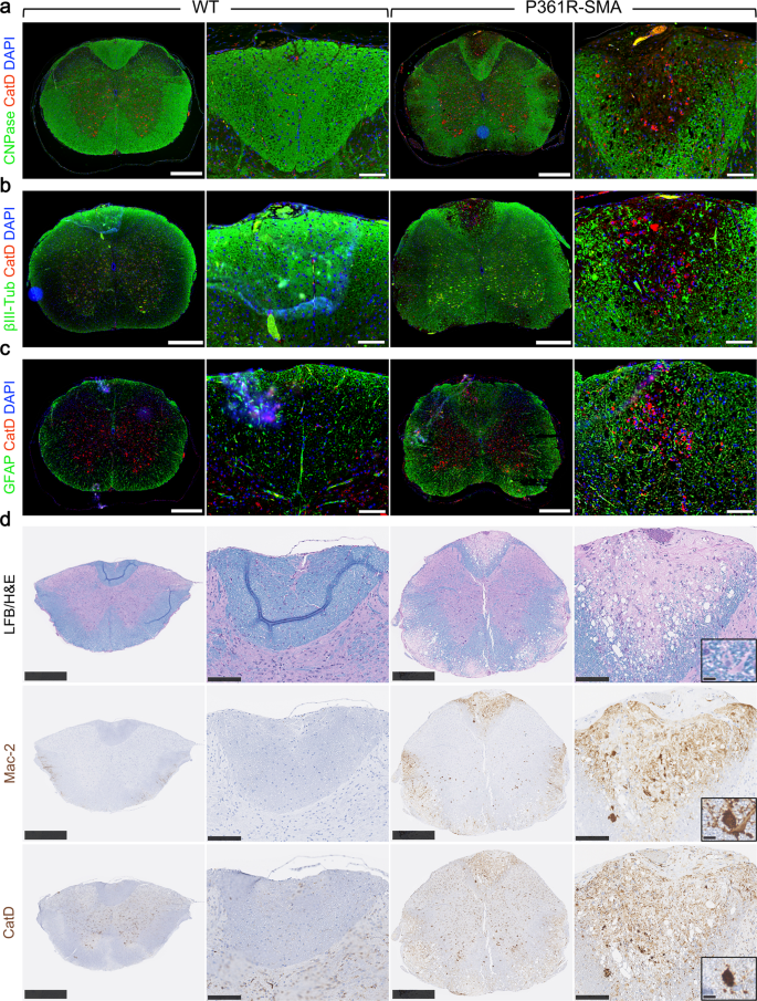 Fig. 6: Immunofluorescent staining for myelin, neurons and phagocytic cells in spinal cord sections from 21-23-week-old P361R-SMA mice.