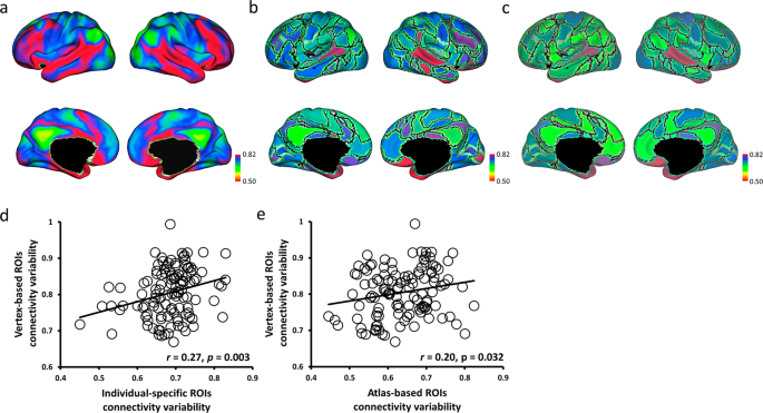 Fig. 2: Individual-specific ROI connectivity was more correlated with vertex-based ROI connectivity than with atlas-based ROI connectivity.