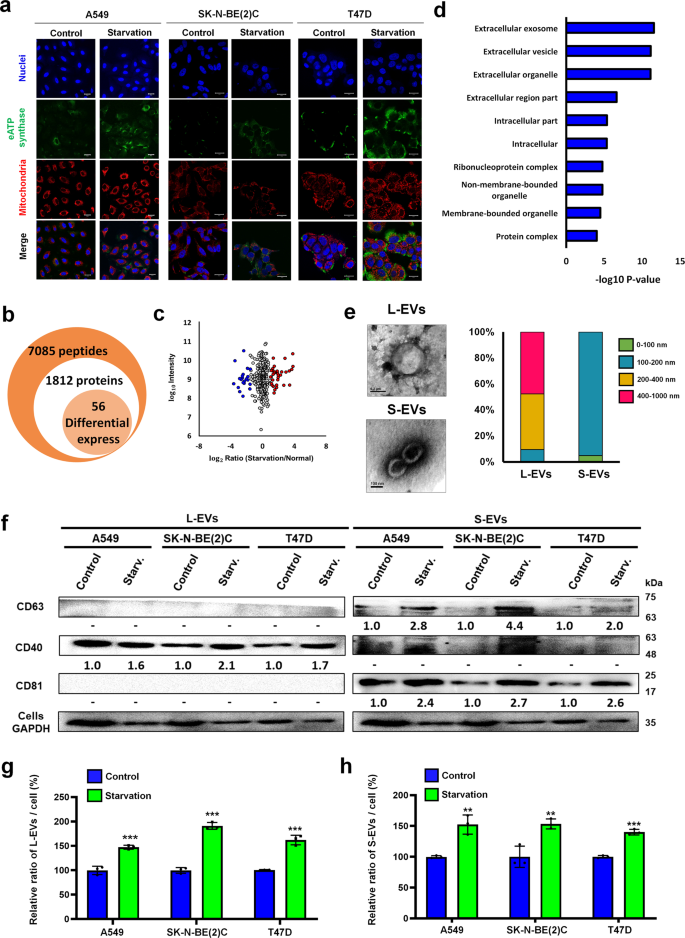 Ectopic ATP synthase stimulates the secretion of extracellular vesicles in  cancer cells