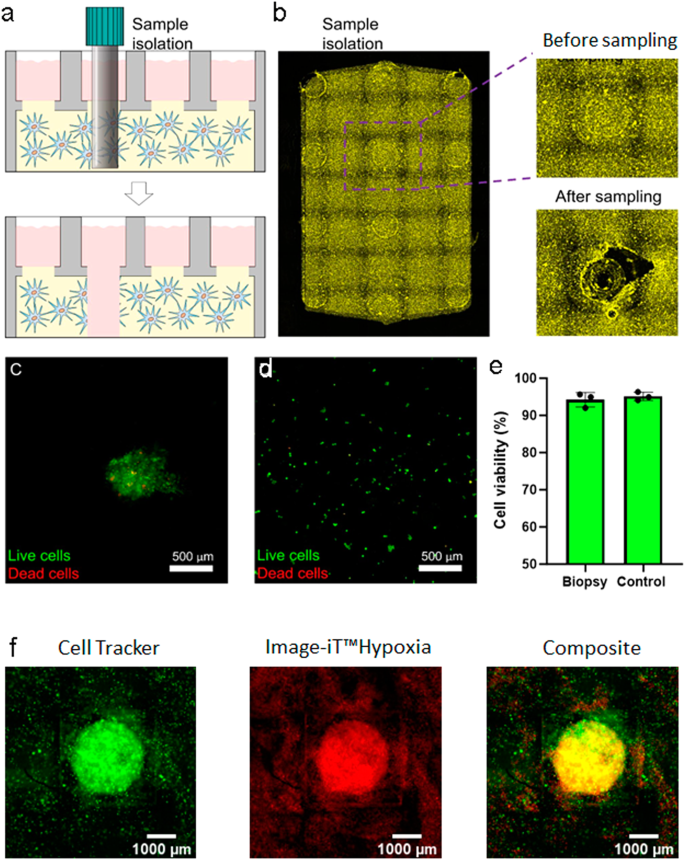 Fig. 5: Generation of biopsy and grafts in Griddient platform.
