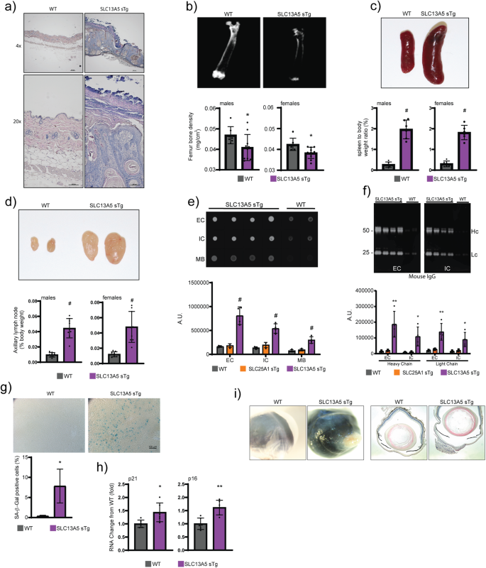 Fig. 2: SLC13A5 sTg mice display a systemic phenotype that is consistent with a segmental form of progeria.