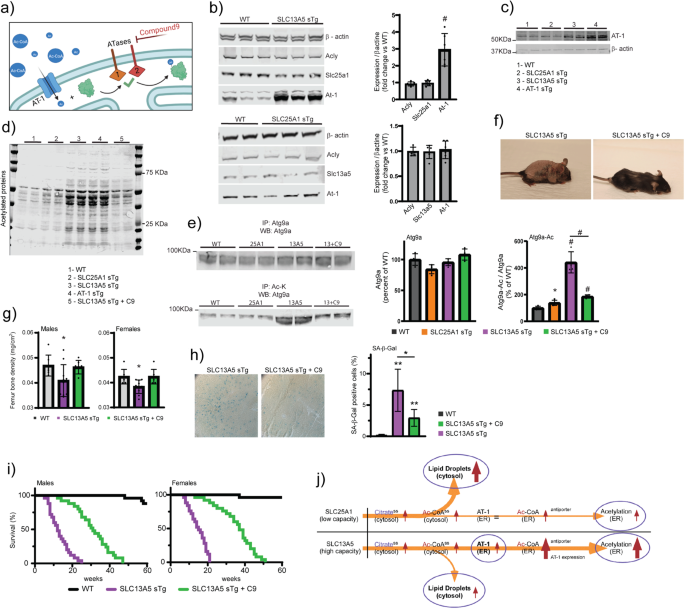 Fig. 7: ATase1/ATase2 inhibition rescues the progeria-like phenotype and lifespan of SLC13A5 sTg mice.