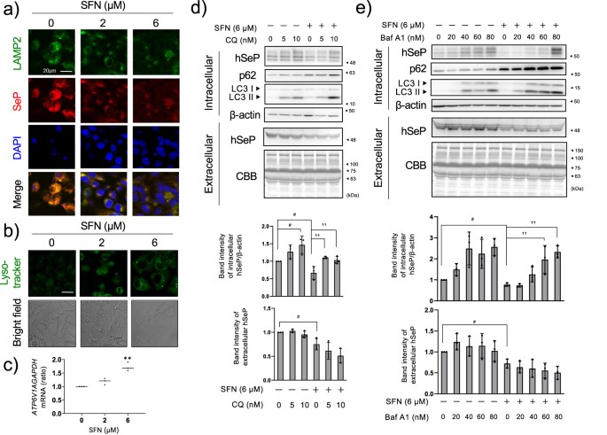 Fig. 2: Involvement of lysosomes in the reduction of SeP by SFN.