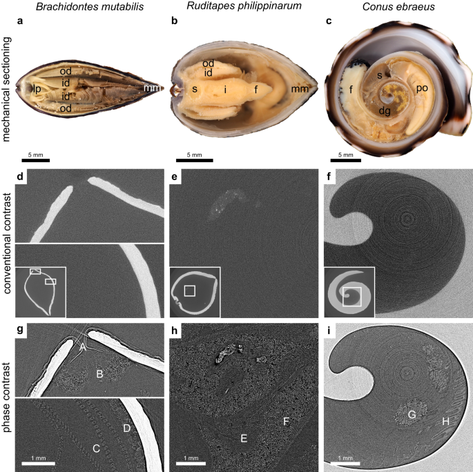 Fig. 3: Phase contrast enables a drastic improvement in soft-tissue visualization.