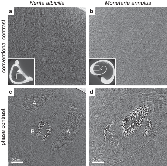 Fig. 4: Difference in contrast for the radula in conventional attenuation-based contrast and phase contrast imaging.