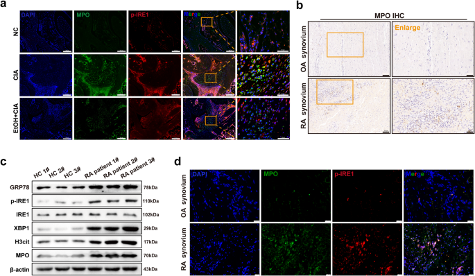 Fig. 3: Ethanol treatment may be associated with the inhibition of ERS and upregulation of IRE1-NETs.