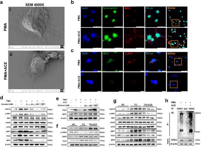 Fig. 6: Acetate reduces ERS in neutrophils and inhibits the formation of NETs.
