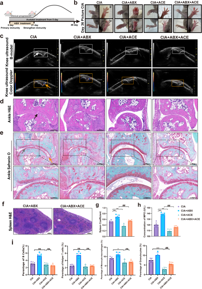 Fig. 7: Exogenous acetate supplementation has a therapeutic effect on CIA mice.