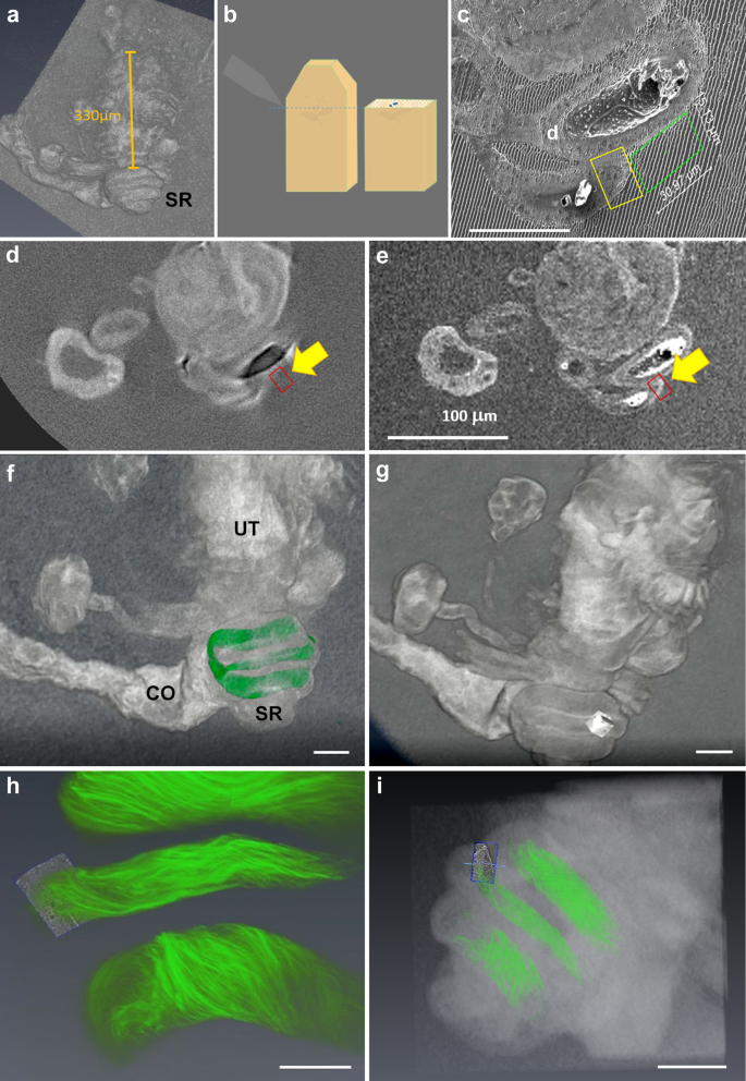 Fig. 3: Description of the correlative work flow for milling the precise region of interest using FIB-SEM.