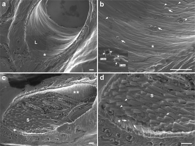 Fig. 6: Scanning electron microscopy showing the inner lumen of virgin and mated distal seminal receptacle.