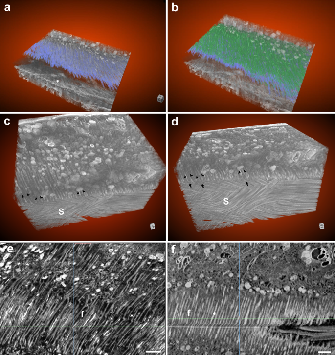 Fig. 7: FIB-SEM visualization of the intima fiber layer in virgin and mated distal seminal receptacle.