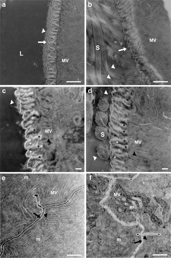 Fig. 8: Mating induces changes in the intima layer at the proximal and distal seminal receptacle.