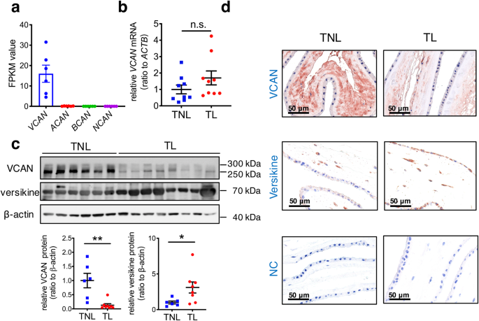 Fig. 1: Reciprocal changes of VCAN and versikine in the human amnion in deliveries with spontaneous rupture of membranes.