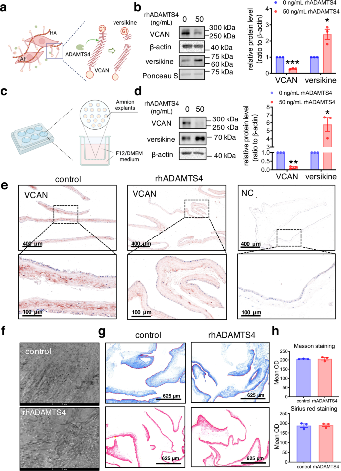 Fig. 3: Effect of ADAMTS4 on VCAN degradation and ECM remodeling in the human amnion.