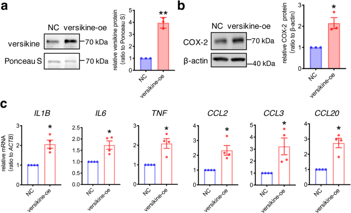 Fig. 6: Stimulation of proinflammatory factors by versikine in human amnion fibroblasts.