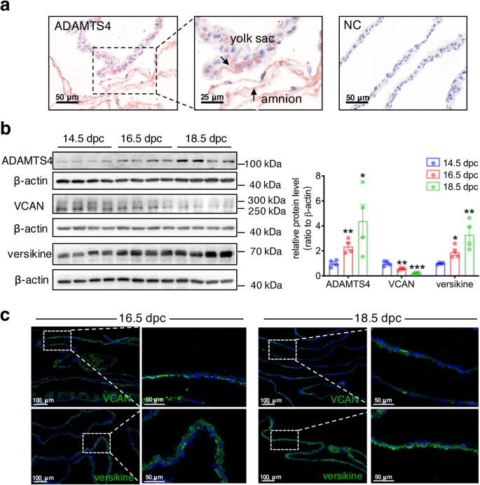 Fig. 7: Gestational age-dependent changes in ADAMTS4, VCAN and versikine abundance in mouse fetal membranes.