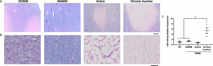 Fig. 1: miR-145-5p is upregulated in chronic lesion tissue from SPMS brains.