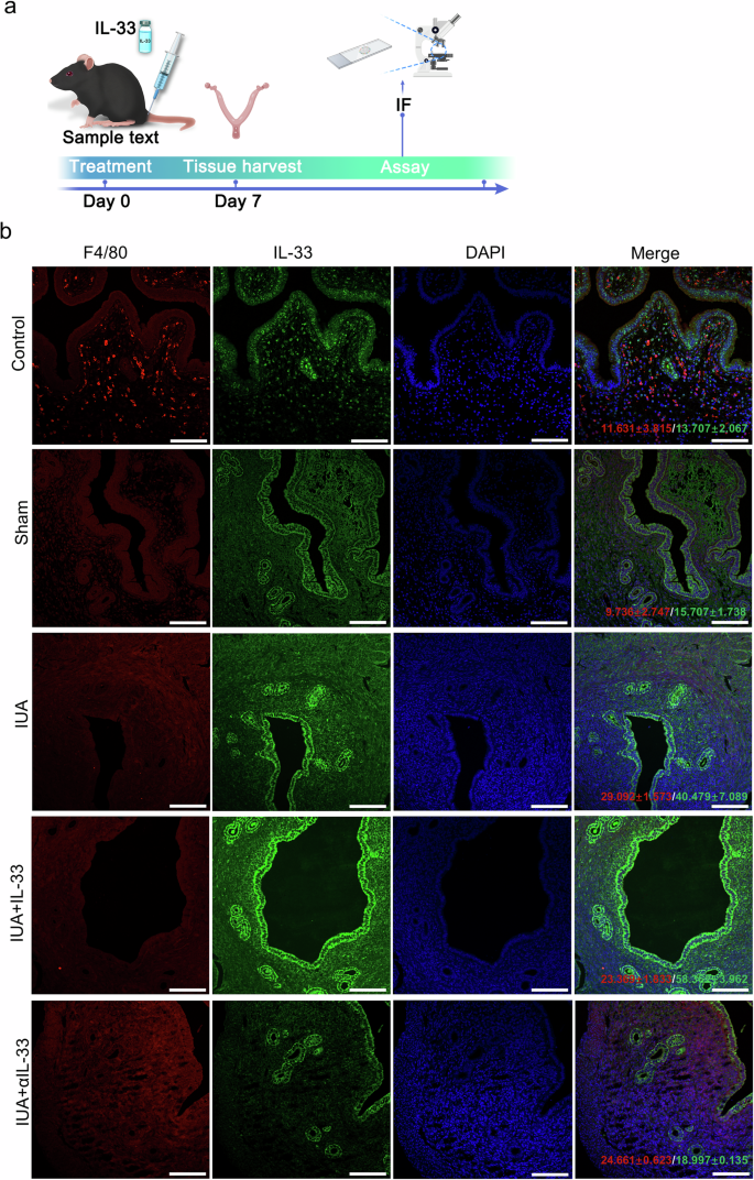 Fig. 7: Macrophages are the source of IL-33 production.
