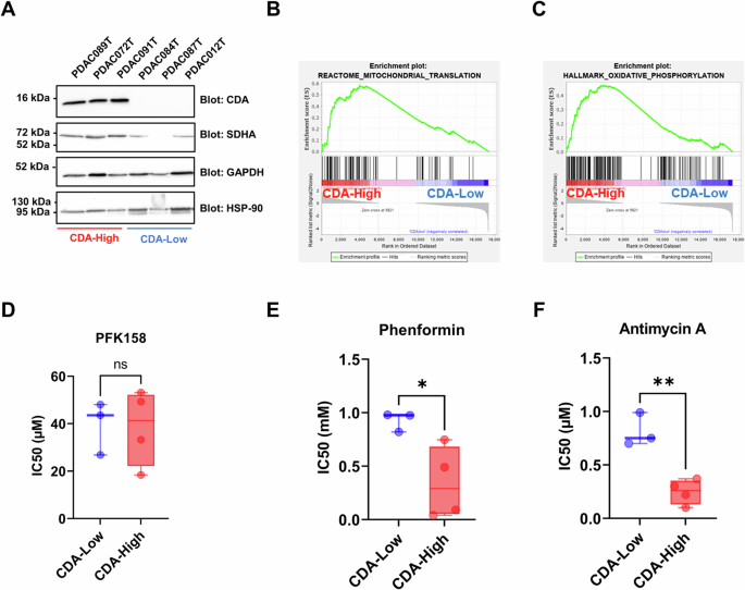 Fig. 4: CDA expression correlates with mitochondrial transcriptomic signature enrichment and sensitivity to mitochondrial-targeting drugs in primary cultures from pancreatic cancer patients.
