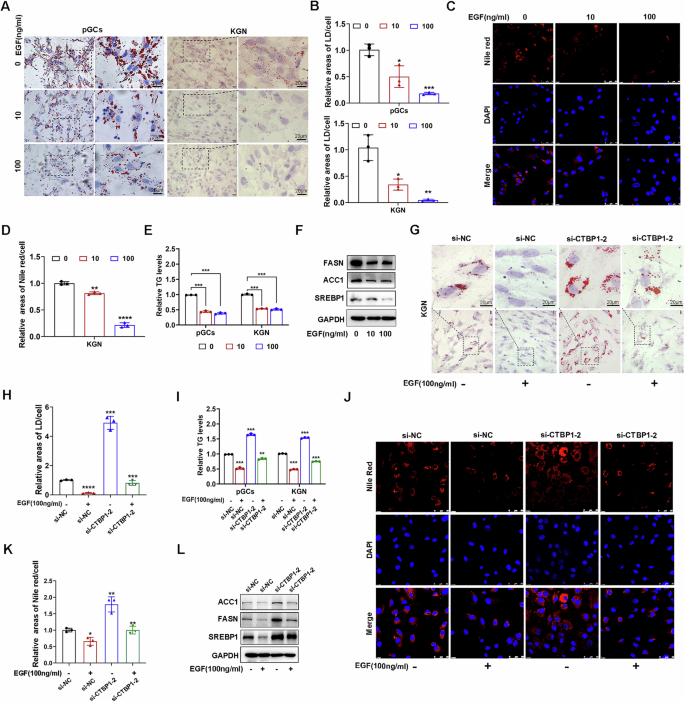 Fig. 5: EGF inhibits lipid droplet synthesis via suppression of SREBP1.